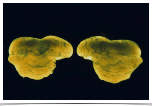 Sagittal otolith of Blunt Scalyhead (Trematomus eulepidotus). 